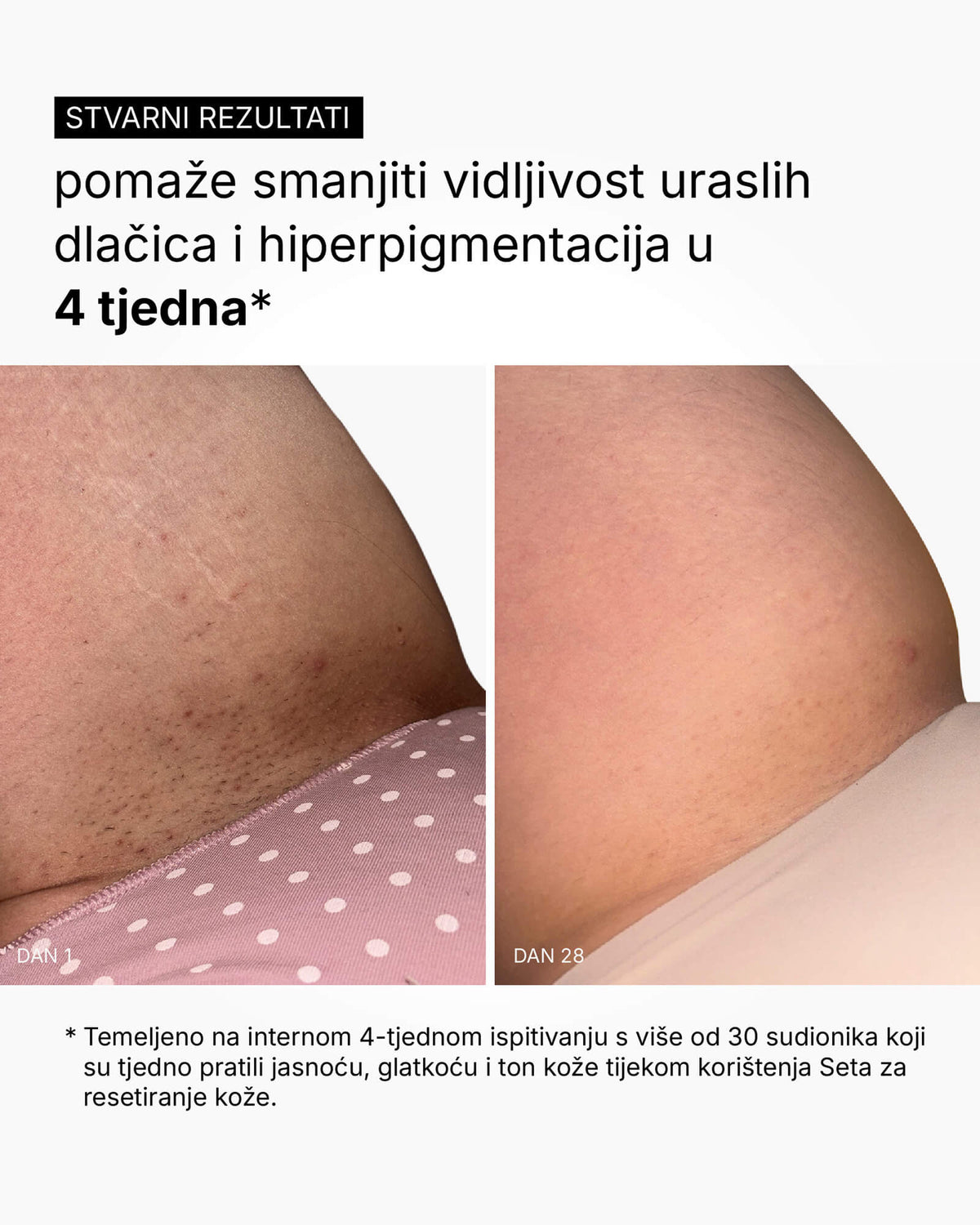 Skin Reset Set - Full Body Routine