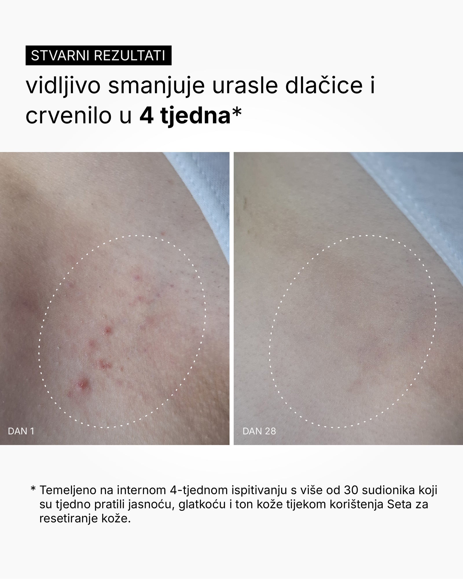 Skin Reset Set - Rotina corporal completa