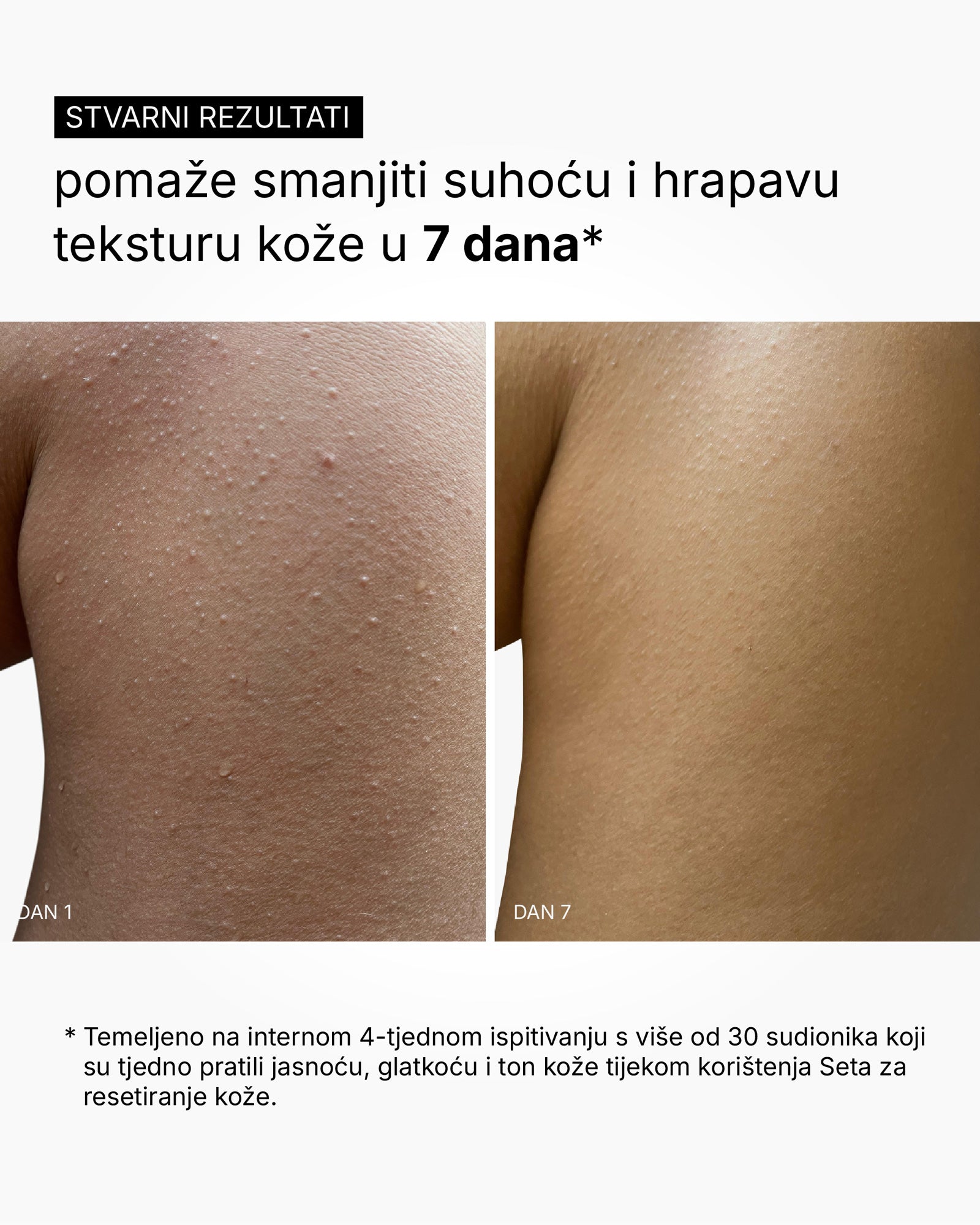 Skin Reset Set - Rotina corporal completa