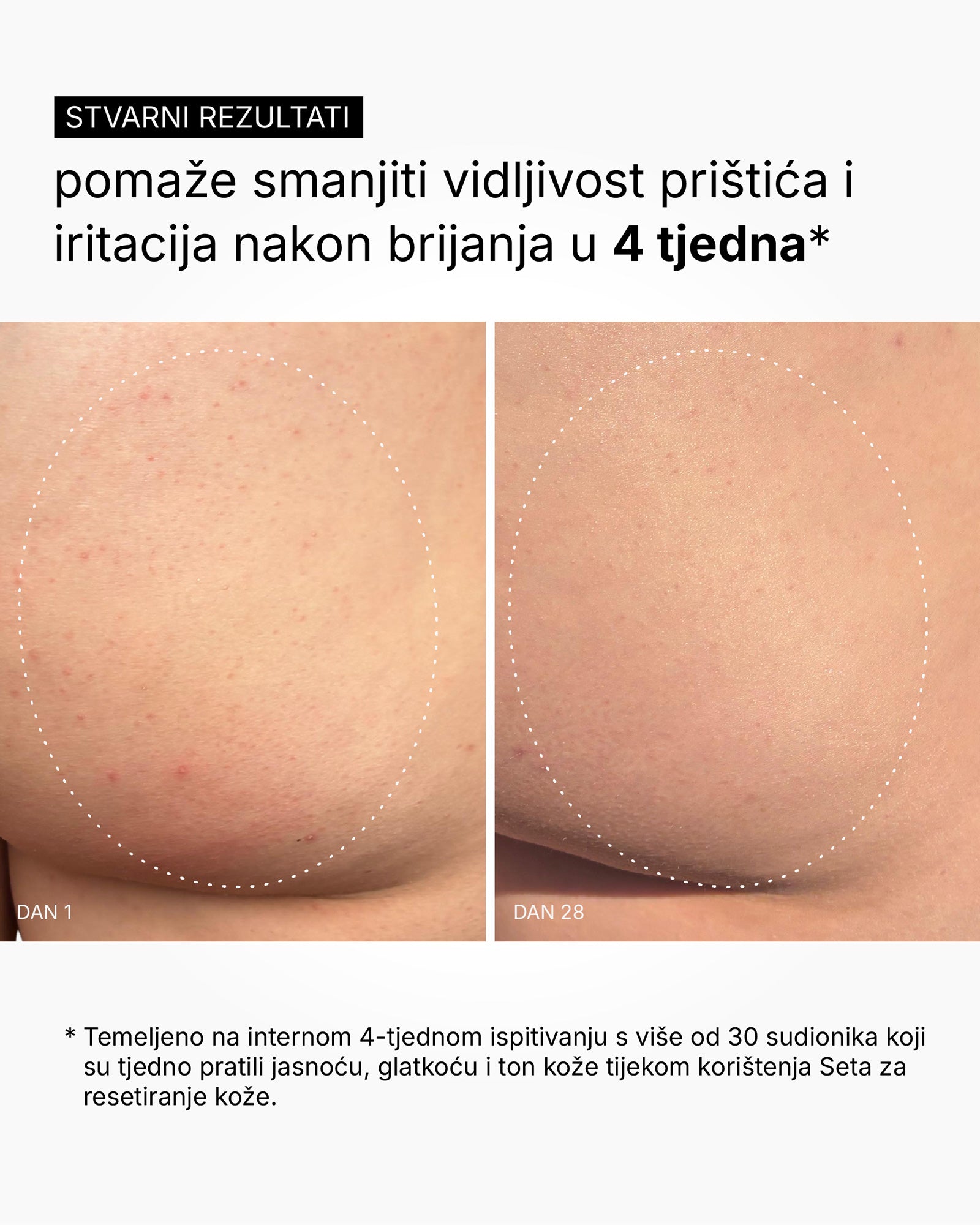 Skin Reset Set - Rotina corporal completa