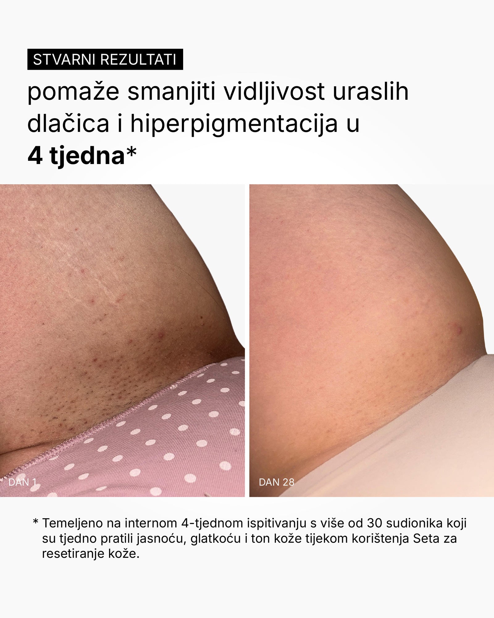 Skin Reset Set - Rotina corporal completa