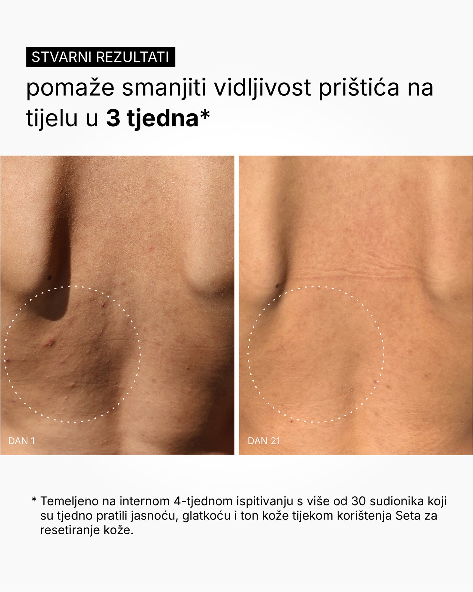 Skin Reset Set - Rotina corporal completa