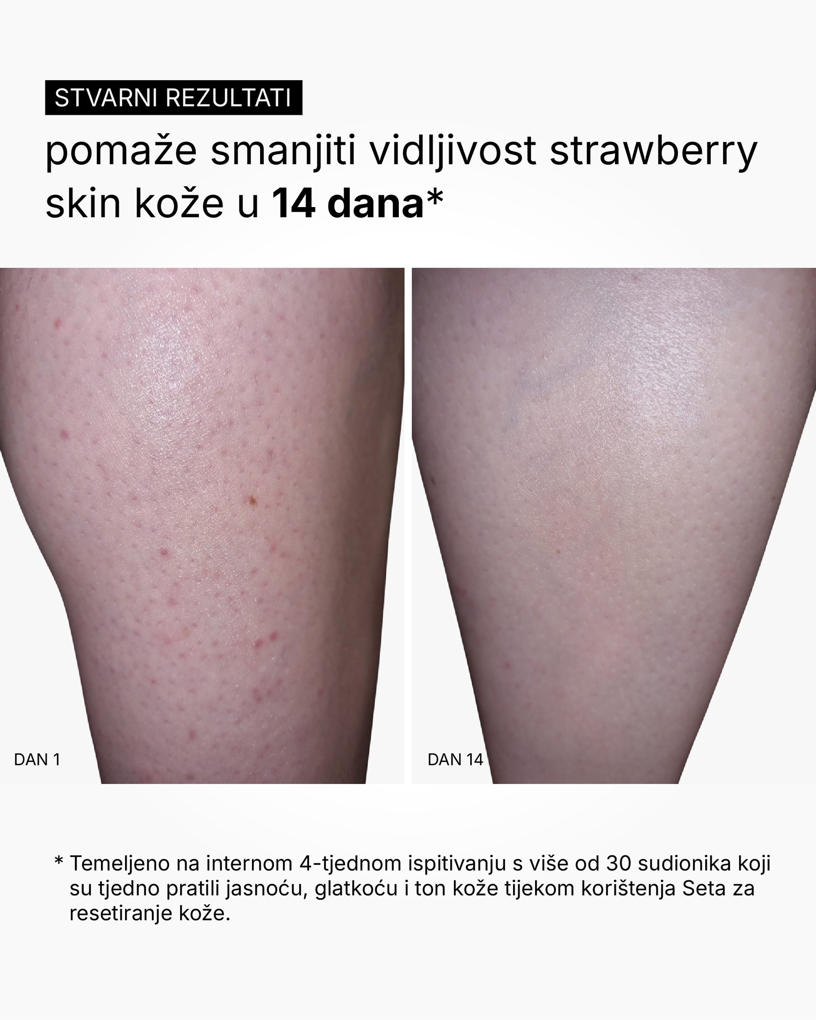 Skin Reset Set - Rotina corporal completa