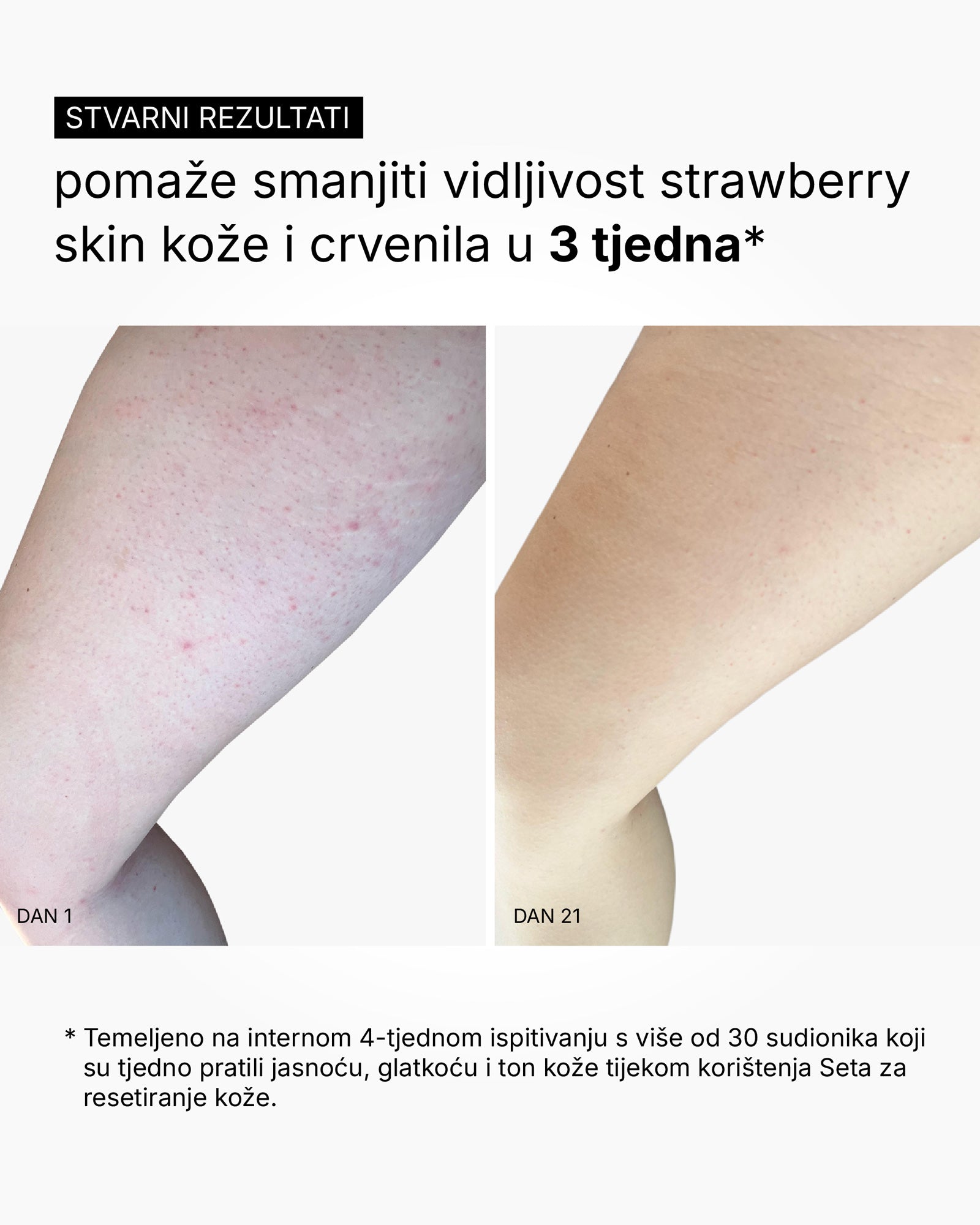 Skin Reset Set - Rotina corporal completa